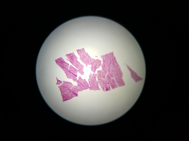 Simple Squamous Epithelium Slides - Simple Squamous Epithelium 03 40X